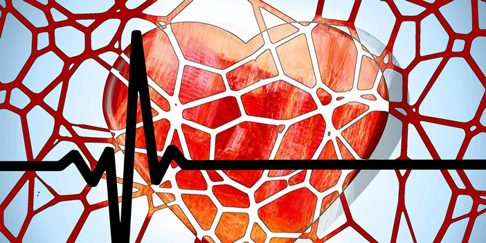 Graphic image of heart with plaque and EKG rhythm