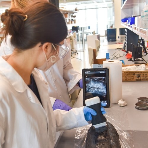 ranger-lab-research-1-500x500.jpg AI/ML for ultrasound user guidance and image analysis