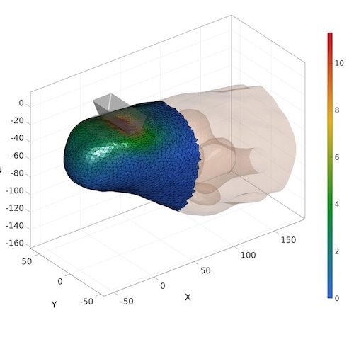 Ultrasound elastography-based assessment of musculoskeletal tissue biomechanics